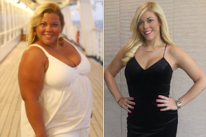 bmi for gastric sleeve