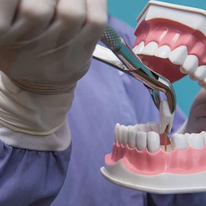 Wisdom Teeth Removal: When And Why Is It Necessary?